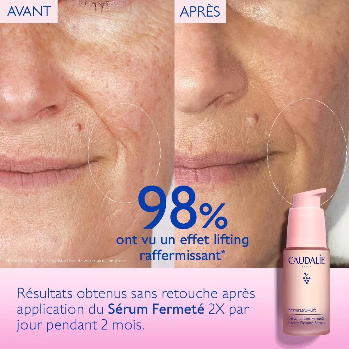 Sérum CAUDALIE Resveratrol-Lift Liftant 30ml avant après résultats fermeté anti-âge - novaparapharmacie