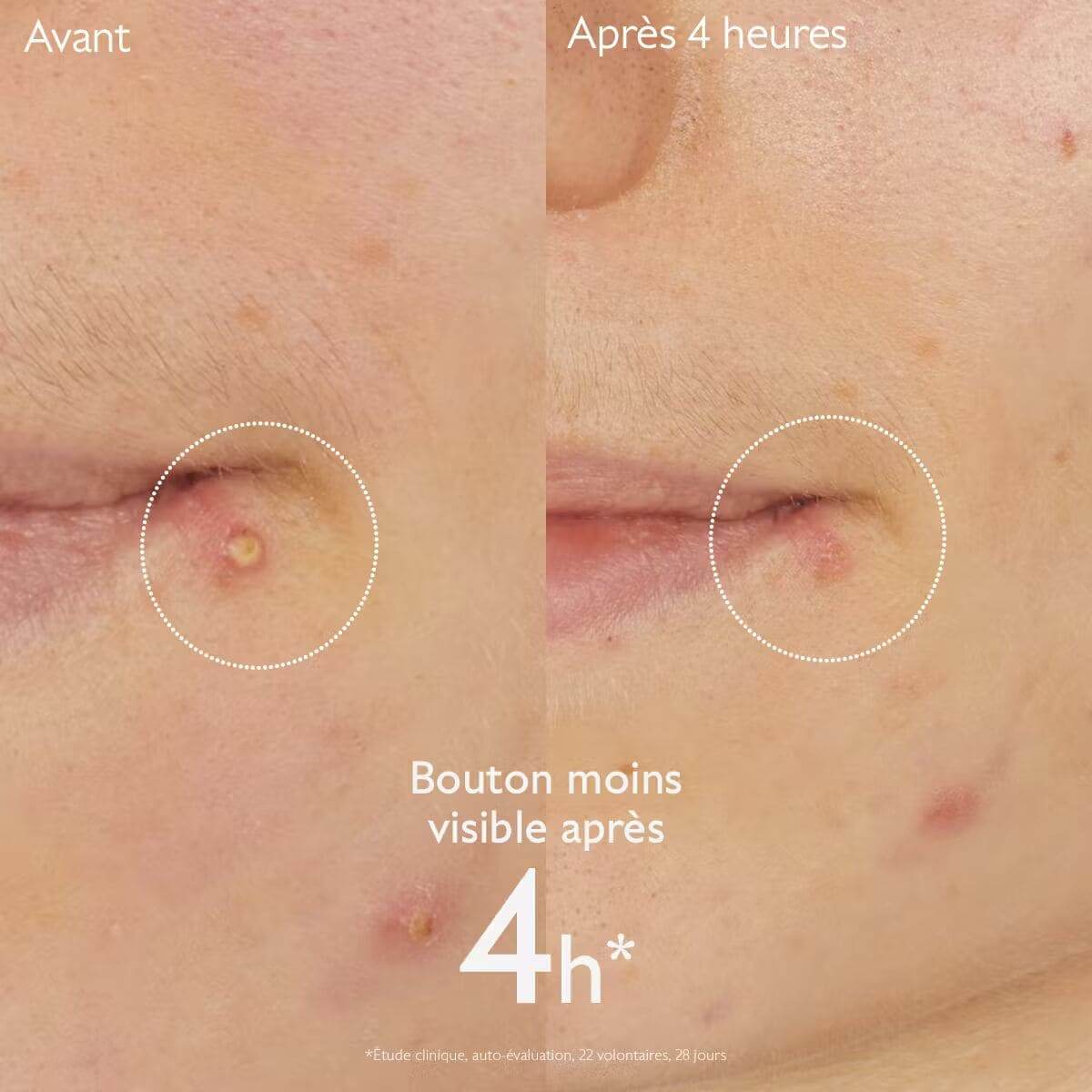 Caudalie Vinopure Stop Boutons 15ml - Nova Parapharmacie