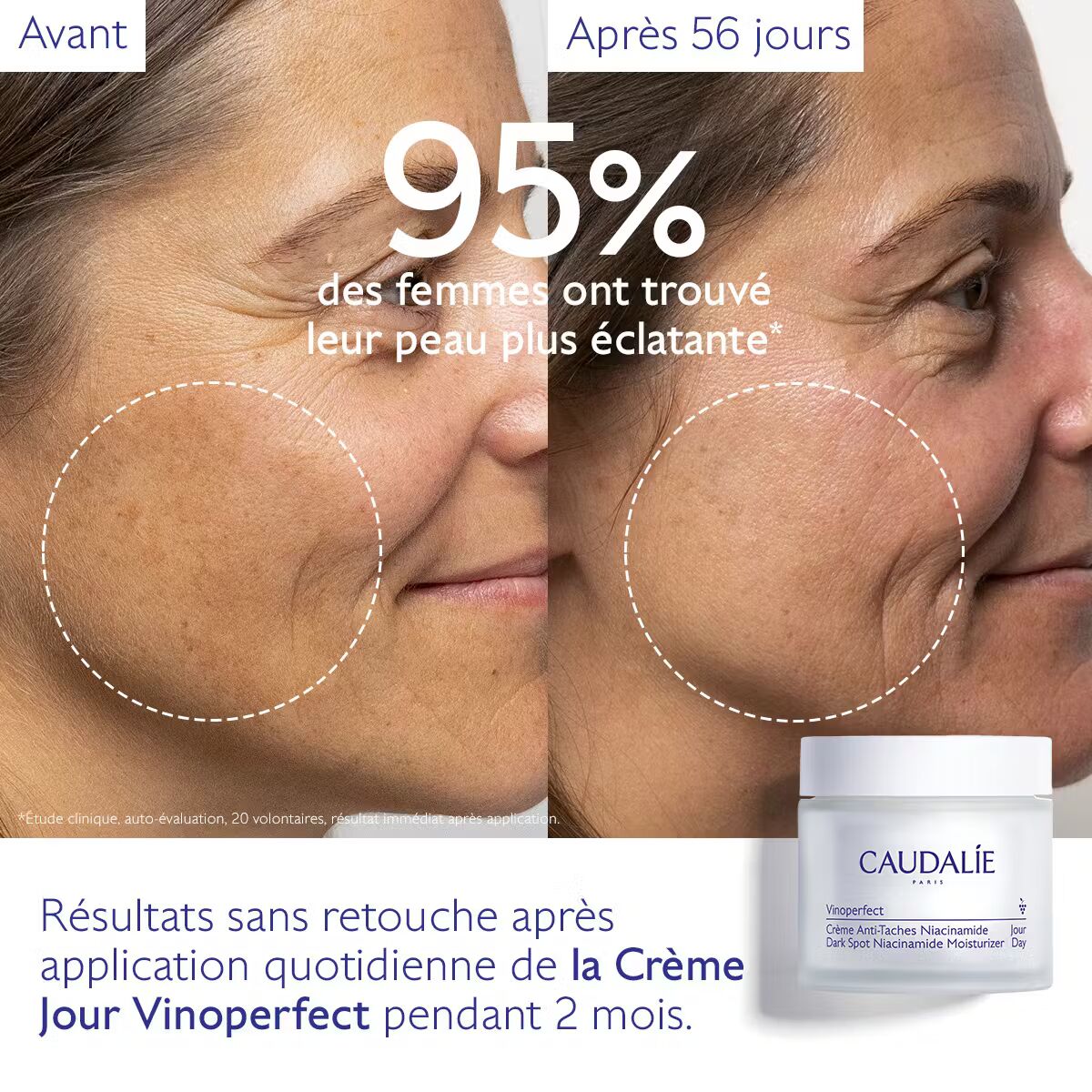 Anti-taches CAUDALIE Vinoperfect Niacinamide 50ml avant après résultats taches éclat - novaparapharmacie