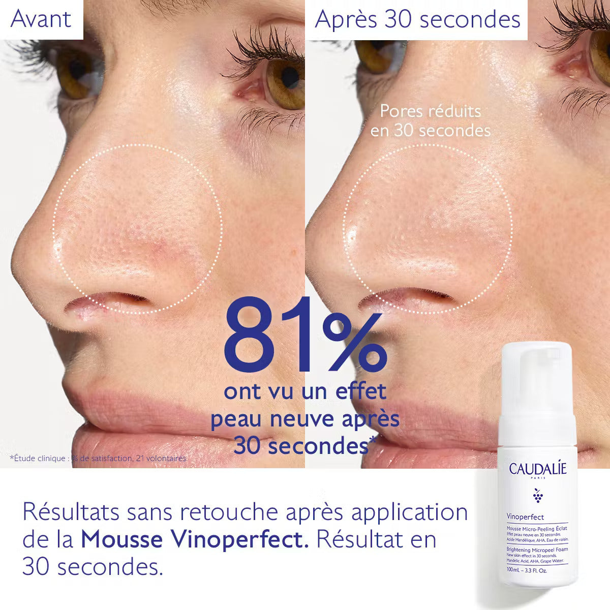 Vinoperfect CAUDALIE Mousse Micro-Peeling Éclat 100ml mousse nettoyante exfoliante micro-peeling éclat nettoyante mousse douce - novaparapharmacie