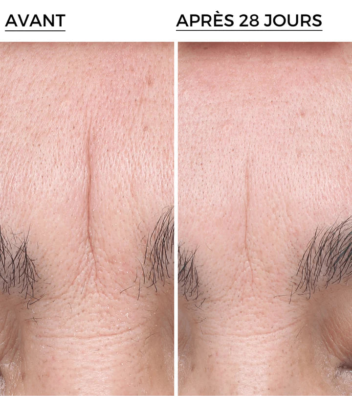 DERMEDEN 30ml Hyal-Filler Concentré application sérum repulpant hydratant anti-rides - novaparapharmacie