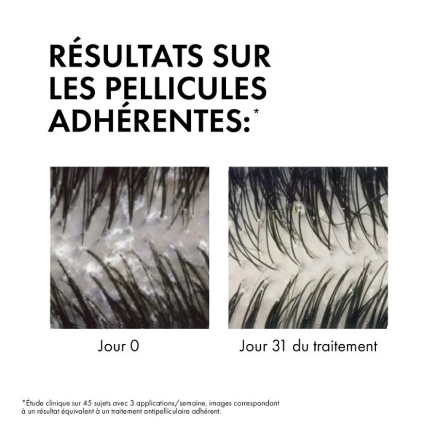 Texture Dercos Eco-Recharge Shampoing Anti-Pelliculaire Cheveux Secs Éco-Responsable Doux - novaparapharmacie