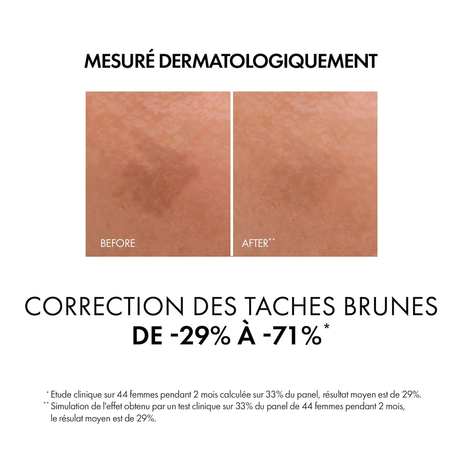 Résultats Avant Après Liftactiv B3 Dark Spots Réduction Taches Pigmentaires Teint Unifié - novaparapharmacie