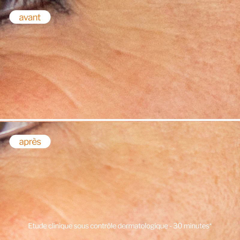 NOVEXPERT 30ml Booster Vitamine C 25% ultra concentré éclat antioxydant - novaparapharmacie
