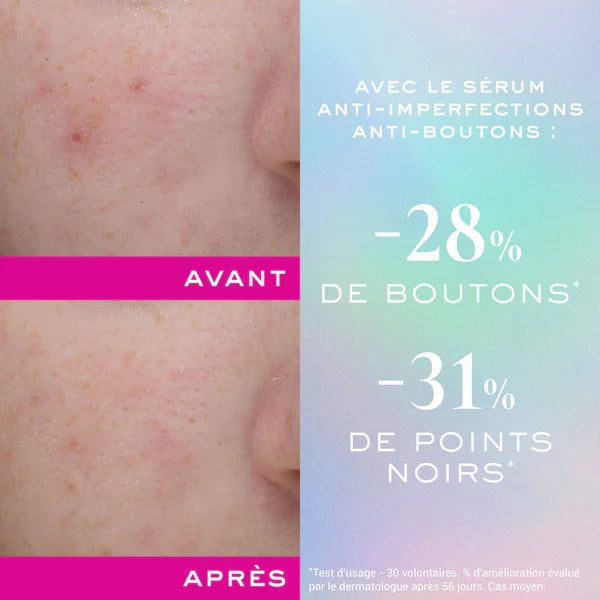 NUXE Zinc Power Sérum Anti-Imperfections avant après résultats anti-boutons peaux grasses - novaparapharmacie