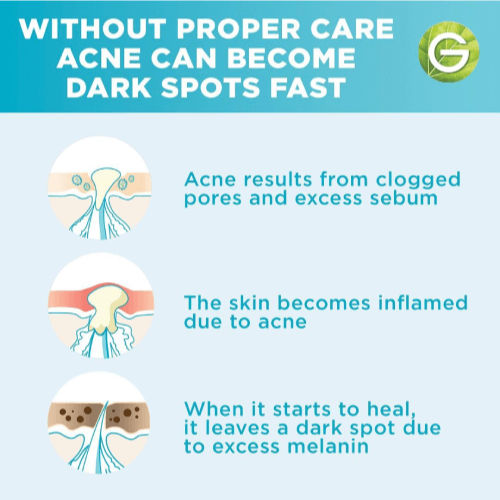 Garnier Fast Clear Booster Serum Acide Salicylique 15ml information acné peau grasse imperfections traitement ciblé  - novaparapharmacie