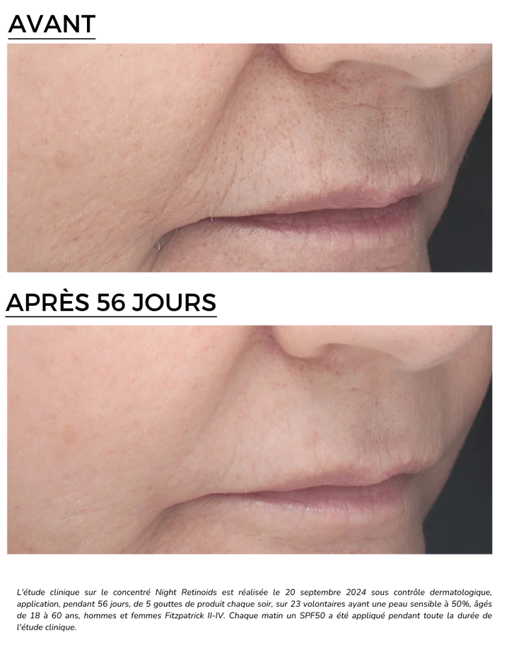 DERMEDEN 30ml RETINAL Concentré Rétinoïdes Nuit sérum anti-âge rétinal rétinal anti-âge puissant soin nuit raffermissement - novaparapharmacie