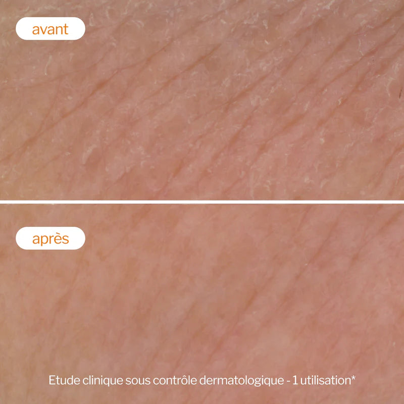 Résultats Novexpert Mousse Flash Éclat Peau Nettoyée Éclatante Vitamine C Radiance - novaparapharmacie