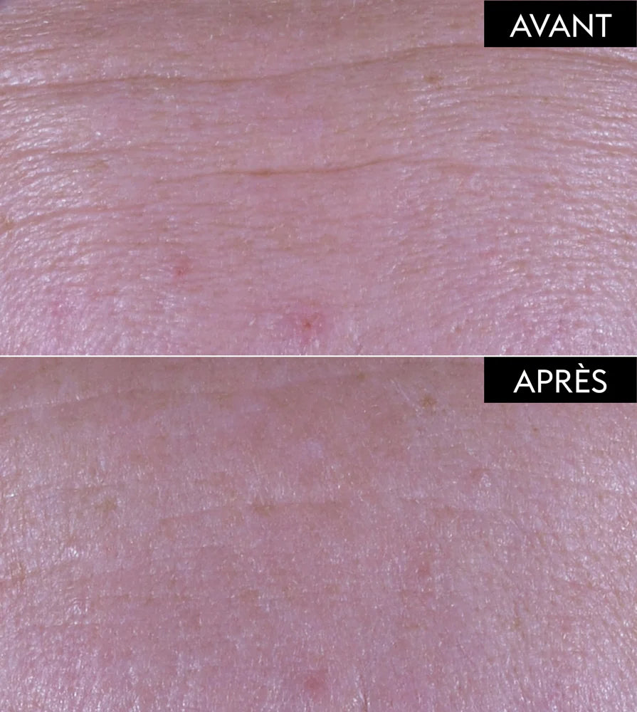 Anti-âge PATYKA PACK Sérum Repulpant Fondamental 30ml sérum repulpant anti-rides fermeté bio acide hyaluronique - novaparapharmacie