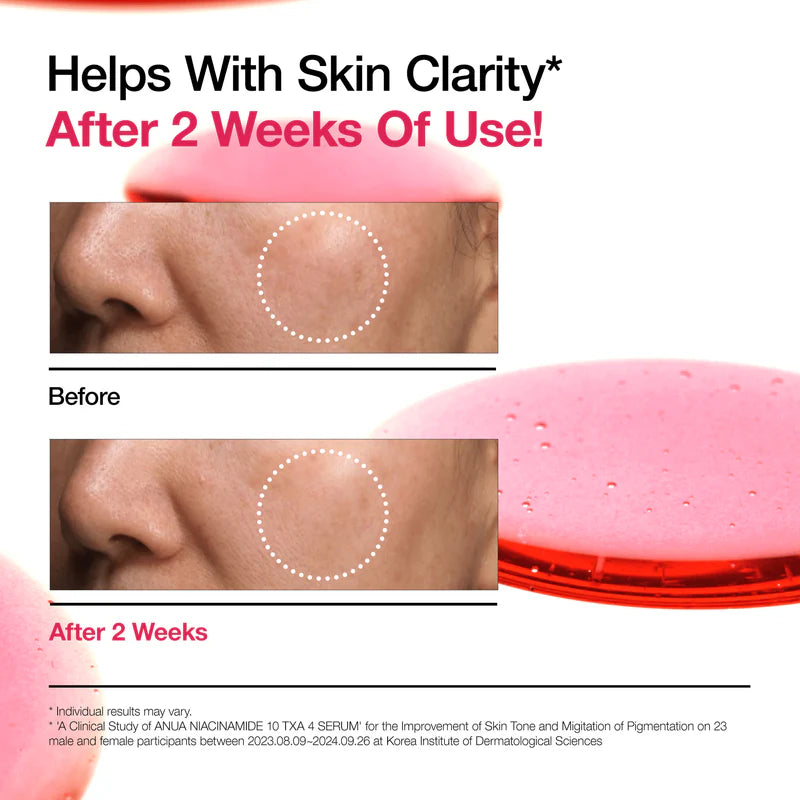 Éclaircissant ANUA Serum Niacinamide 10% + TXA 4% 30ml sérum anti-taches niacinamide 10% acide tranexamique 4% - novaparapharmacie