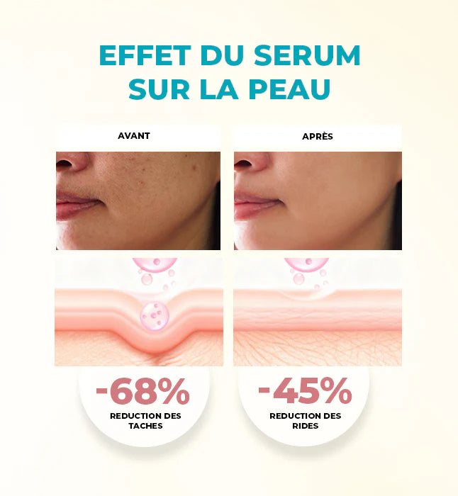 GLEAMY Sérum Multi-Revitalisant avant après résultats peau repulpée hydratée rides - novaparapharmacie
