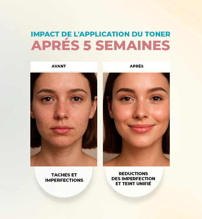 GLEAMY Toner Micro-Peeling avant après résultats peau lisse éclat imperfections - novaparapharmacie