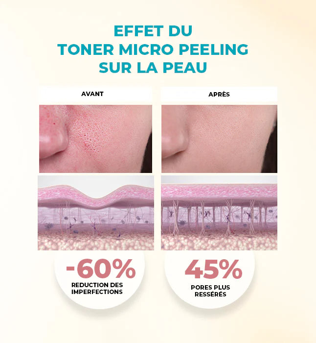 GLEAMY Toner Micro-Peeling avant après pores resserrés texture améliorée taches - novaparapharmacie