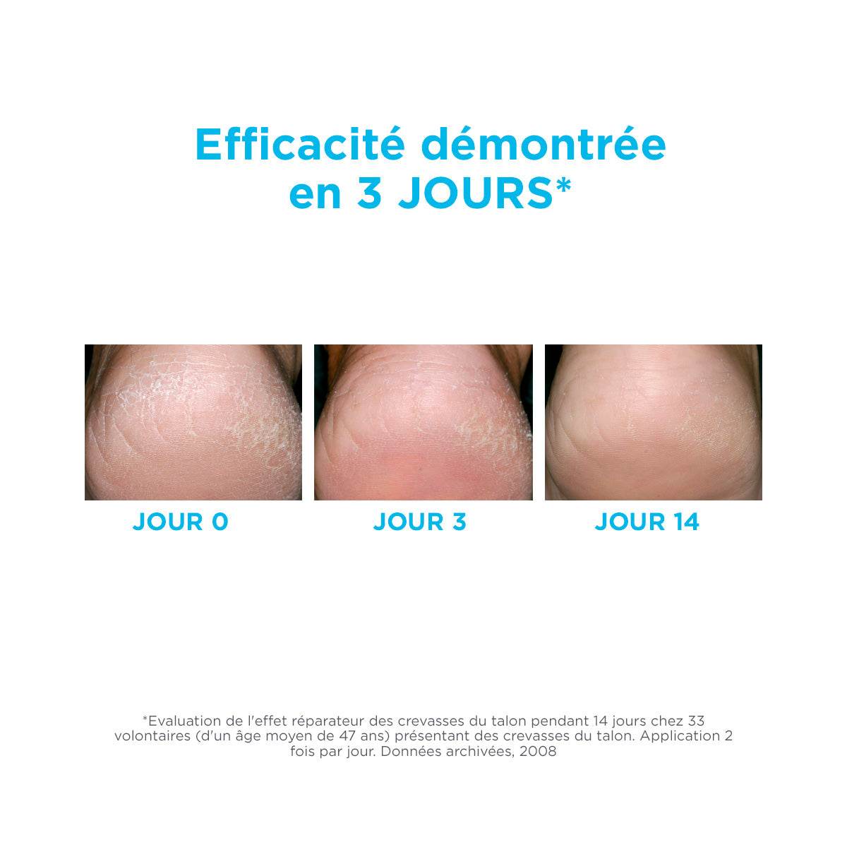 ISDIN Ureadin Crème Pieds 75ml - Crème Pieds Hydratante Peau Élastique - Nova Parapharmacie