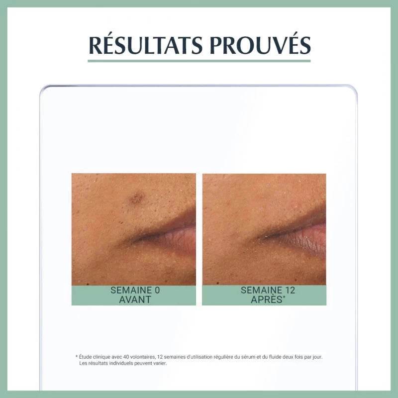 EUCERIN Dermo Purifyer Triple Effect Sérum résultats anti-acné triple action réduction imperfections peaux grasses dermatologie efficac