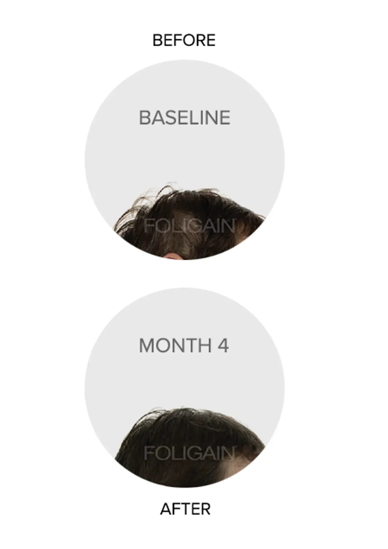 oligain bénéfices triple action anti-chute trioxidil 10% ultra-concentré densité volume traitement intensif femme - novaparapharmacie