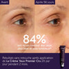 Comparaison contour yeux avant après Premier Cru Caudalie anti-âge global rides poches cernes résultats