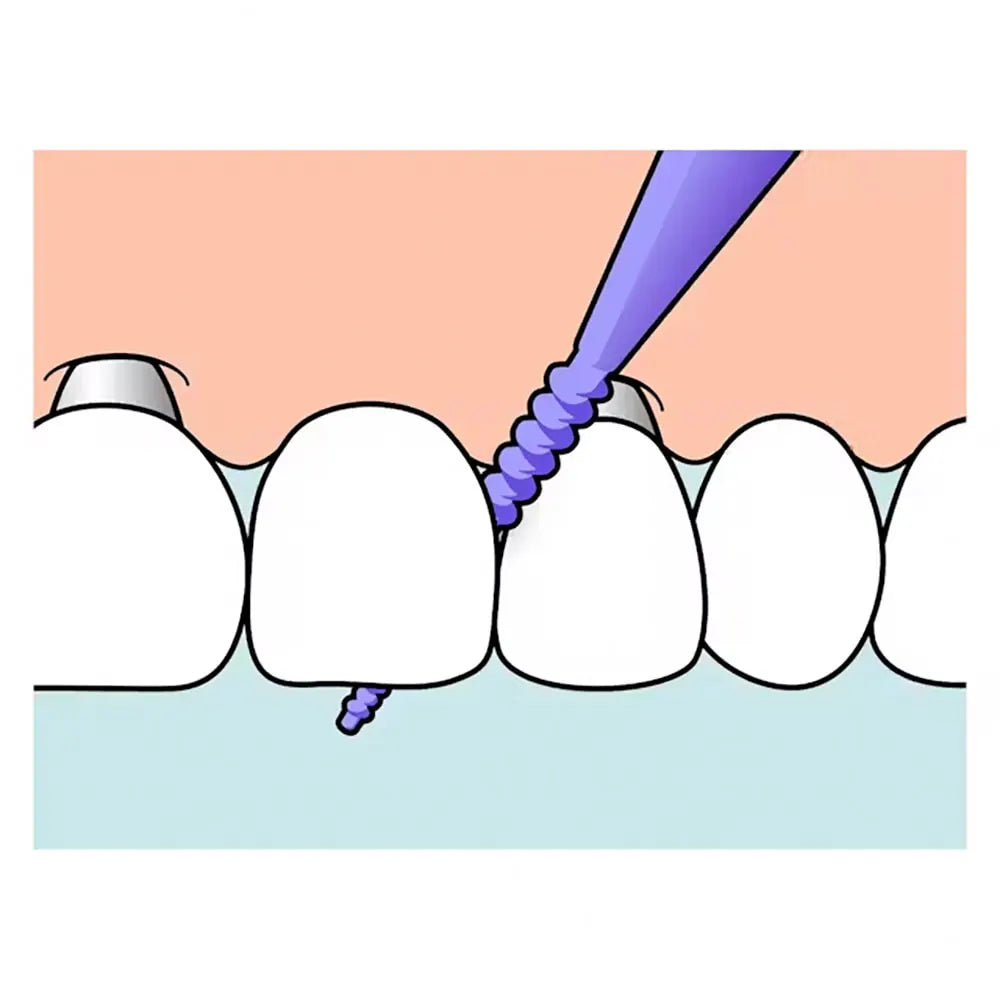 Interdentaires TePe EasyPick 36 Pièces Taille XL Violet bâtonnets silicone nettoyage interdentaire silicone doux taille XL 36 pièces - novaparapharmacie