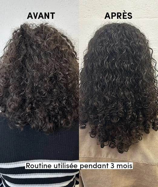WAAM PACK d'Huiles Spéciales Pousse Cheveux Trio Stimulant Croissance Capillaire Ricin Nigelle Coco Bio Fortifiant Naturel